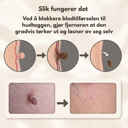 HudtagFritt™